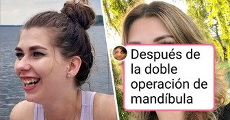 18 Personas que gracias a una cirugía lograron brillar más que siempre