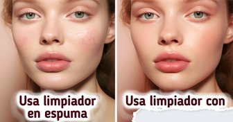 8 Estrategias de dermatología para cuidar la piel y conservar su brillo en el frío